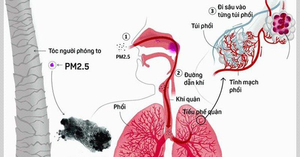 Không khí có thể bị ô nhiễm và gây tác hại tới hoạt động hô hấp (ảnh 1)