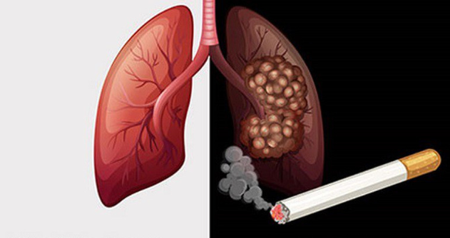 Hút thuốc lá có hại như thế nào cho hệ hô hấp (ảnh 1)