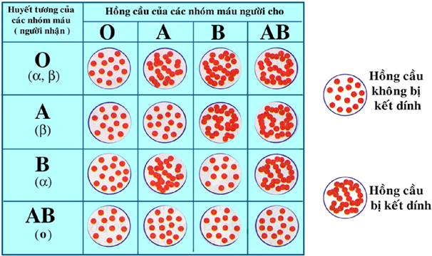 Máu có cả kháng nguyên A và B có thể truyền cho người (ảnh 1)