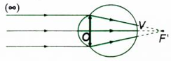 Các dạng bài tập về mắt và cách giải – Vật lý lớp 11 (ảnh 1)