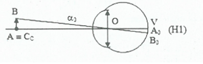 Bài tập về kính lúp và cách giải – Vật lý lớp 11 (ảnh 1)