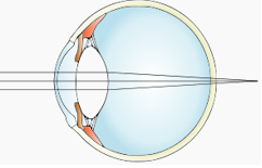 Công thức về mắt hay, chi tiết - Vật lý lớp 11 (ảnh 1)