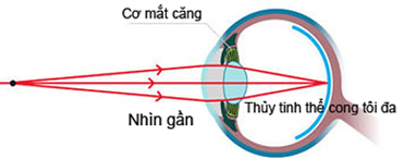 Lý thuyết Mắt | Vật lí lớp 11 (ảnh 1)