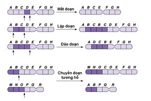 Trường hợp nào sau đây nó về hậu quả của đột biến cấu trúc NST là sai (ảnh 1)