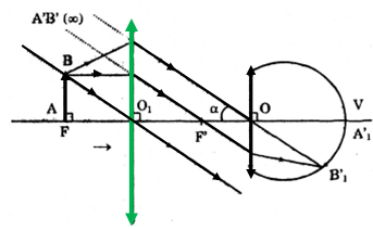 Viết công thức số bội giác của kính lúp trong trường hợp này (ảnh 1)