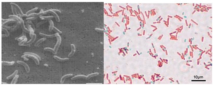 Vi khuẩn có thể hình thành các loại bào tử nào (ảnh 1)