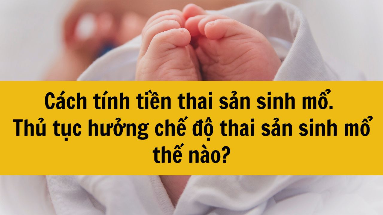 Cách tính tiền thai sản sinh mổ chuẩn quy định 2025. Thủ tục hưởng chế độ thai sản sinh mổ thế nào?