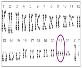Giáo án điện tử Sinh học 12 (Kết nối tri thức): Bài 14: Thực hành: Quan sát một số dạng đột biến nhiễm sắc thể (ảnh 1)