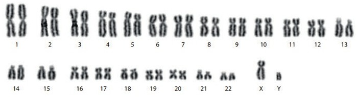 Giáo án điện tử Sinh học 12 (Kết nối tri thức): Bài 13: Di truyền học người và di truyền y học (ảnh 1)