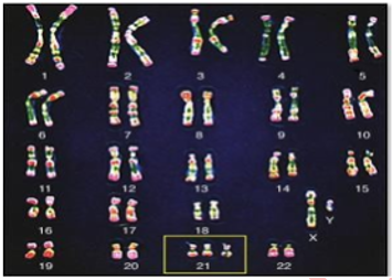 Trắc nghiệm Sinh học 9 Bài 23 có đáp án - Đột biến số lượng nhiễm sắc thể (ảnh 1)